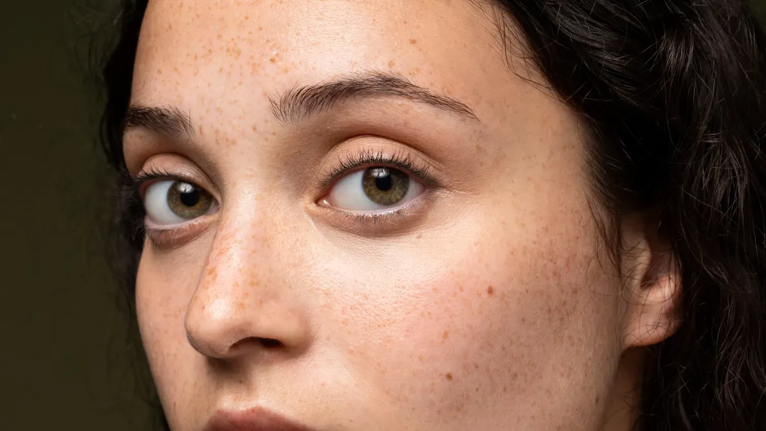 Will Pigmentation Go Away? Everything You Need to Know