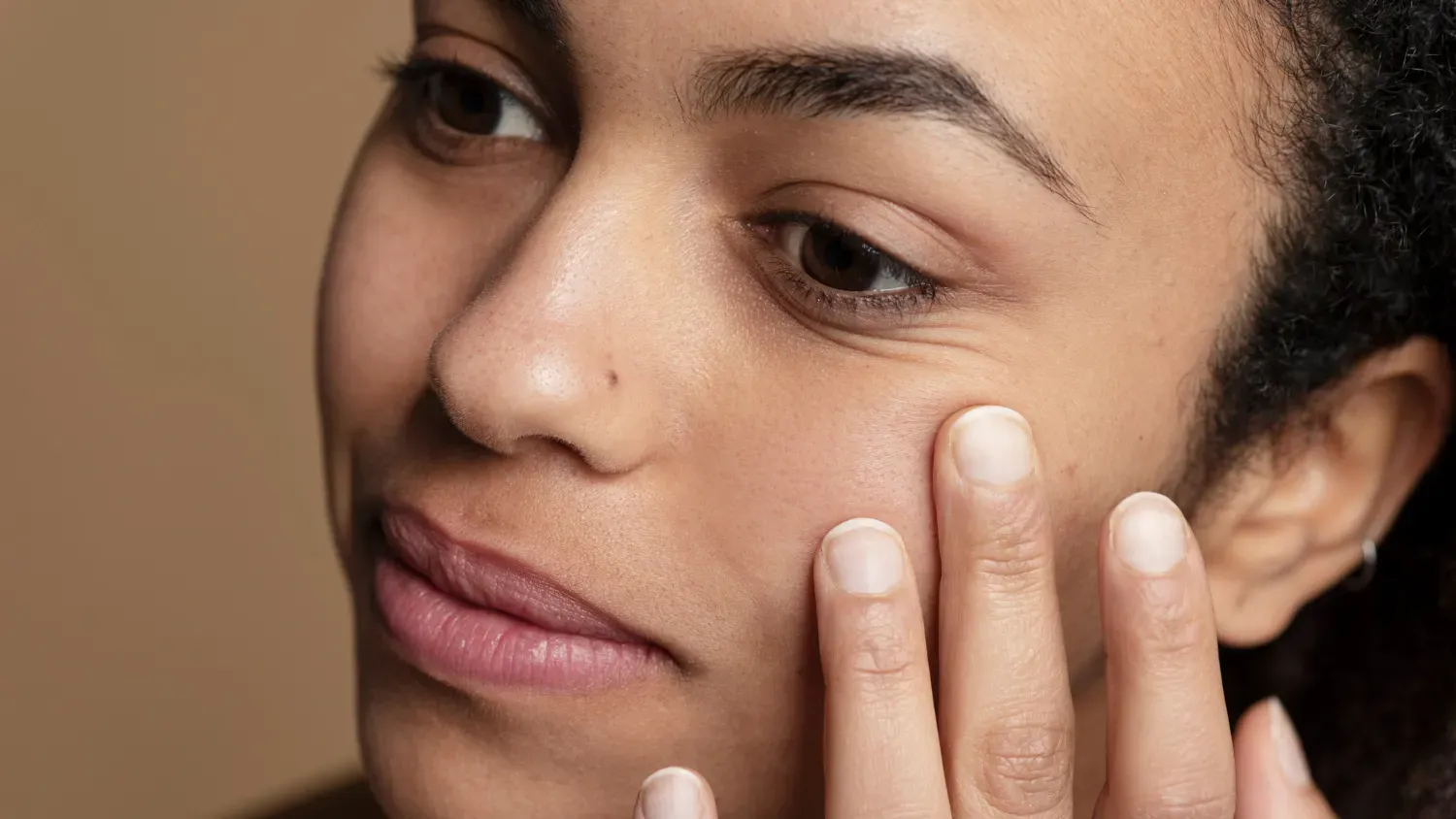 How to Treat Hyperpigmentation: 8 Effective Solutions for Skin Care