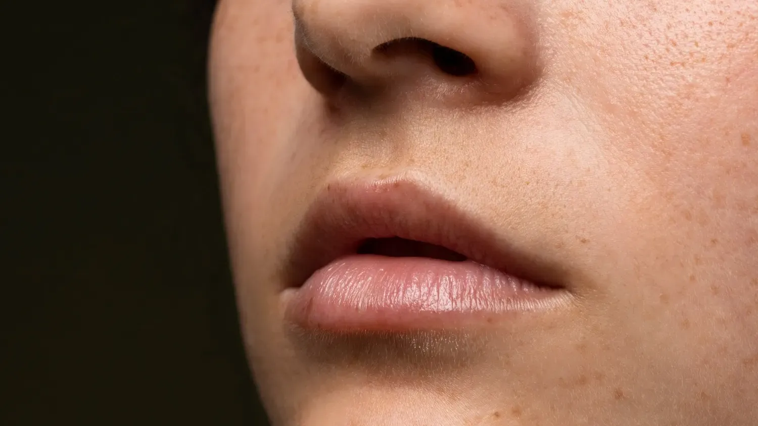 Understanding Hyperpigmentation Around the Mouth