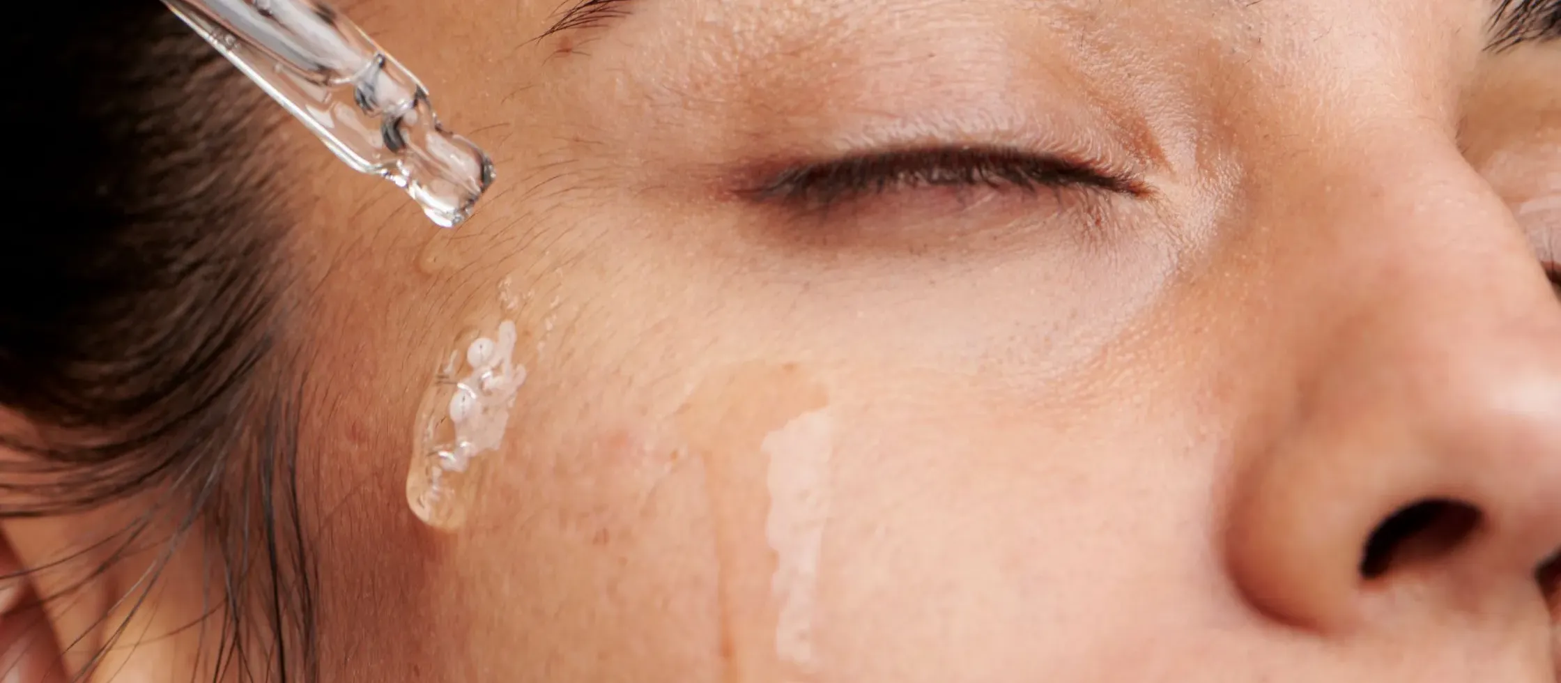 Effective Acne Serums for Dry Skin: Your Ultimate Guide