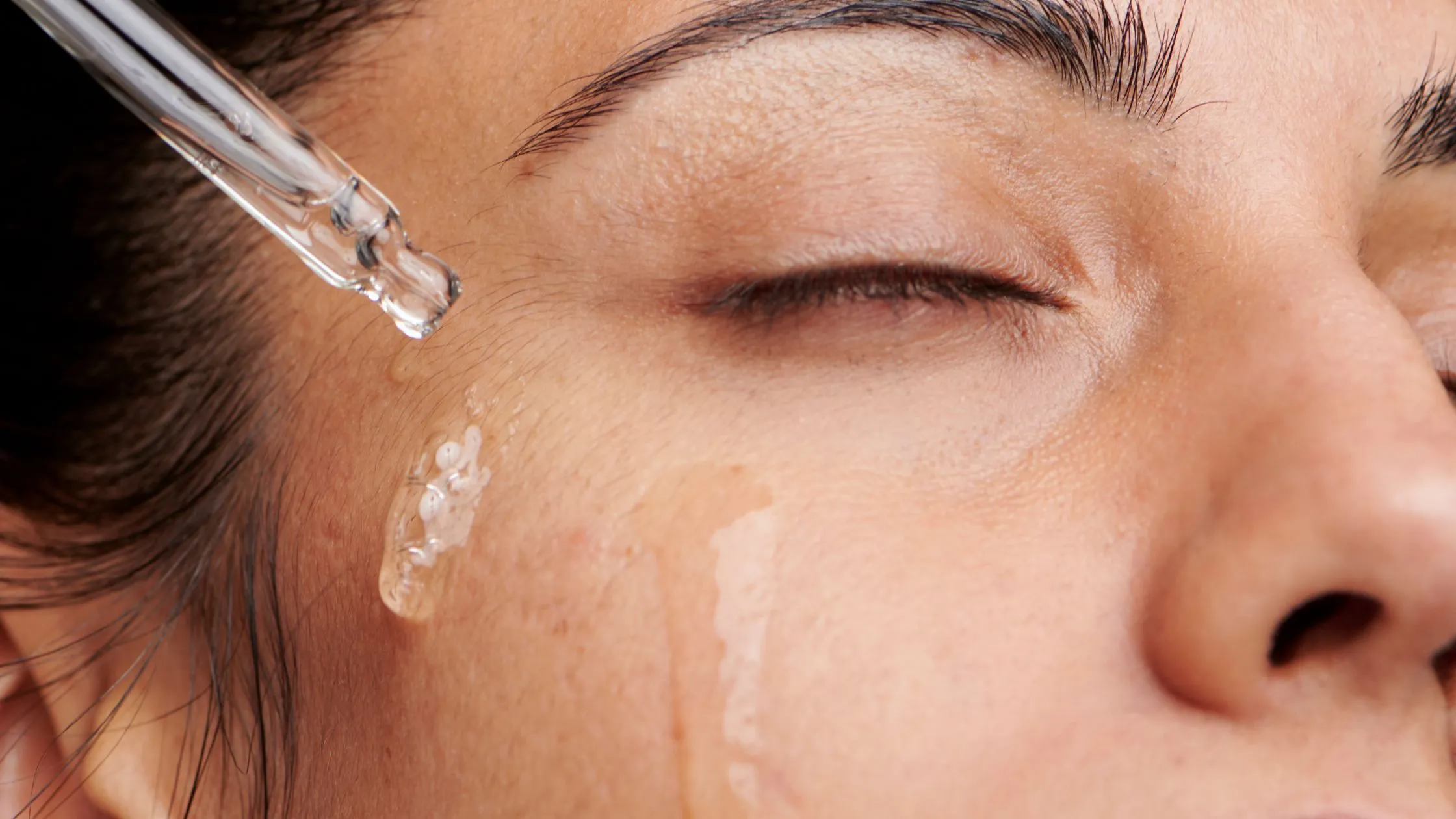 Unlock Radiant Skin: Best Solutions for Pigmented Skin