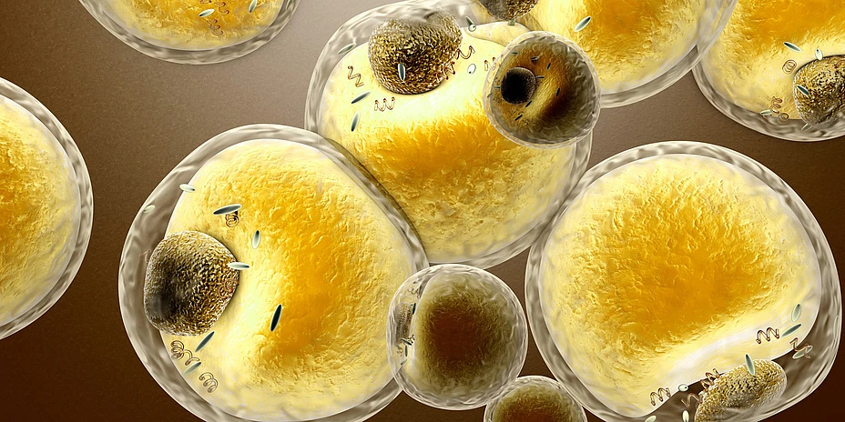 Understanding Triglycerides: Key Causes and Management Strategies