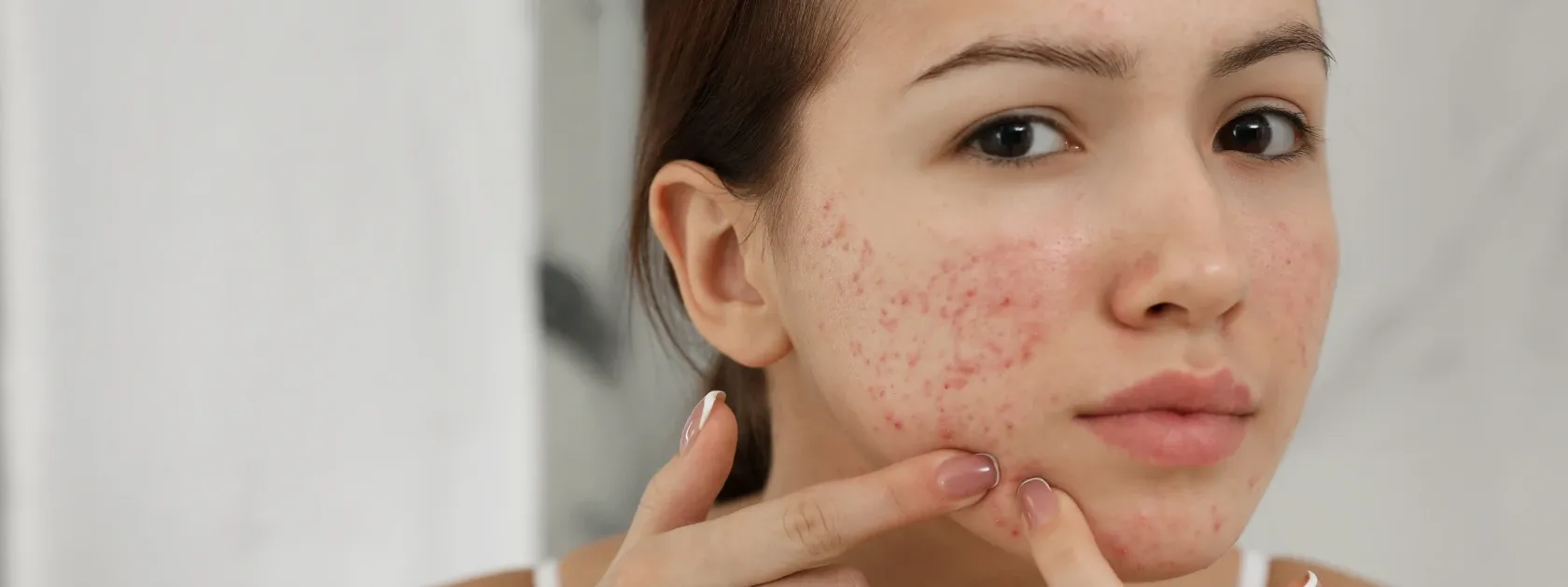 11 Best Stress Breakouts Creams and Serums for Clearer Skin
