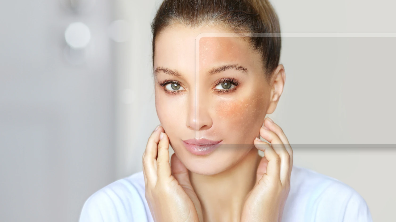 Step-by-Step Guide to Hyperpigmentation Treatment Without Harsh Chemicals