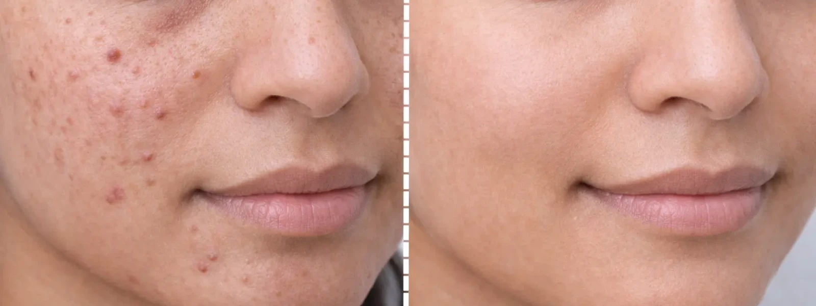 6 Must-Have Daily Essentials for Oily Skin