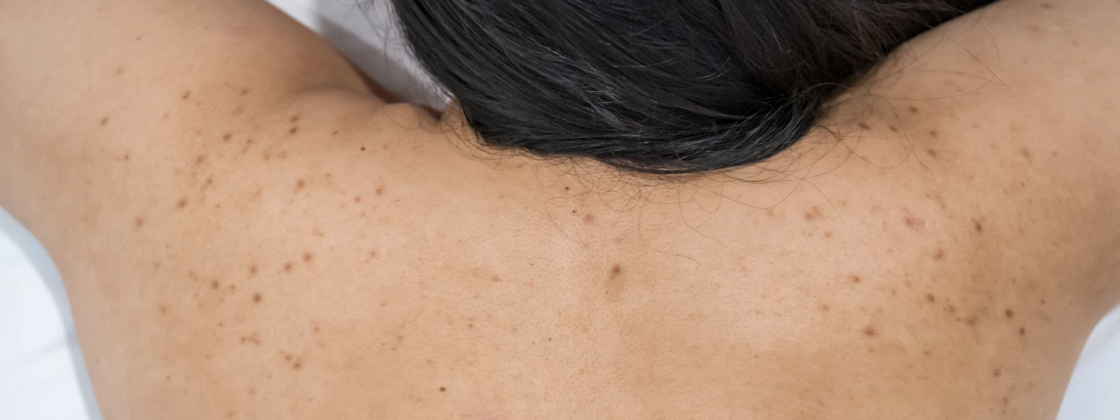 8 Targeted Products for Body Pigmentation