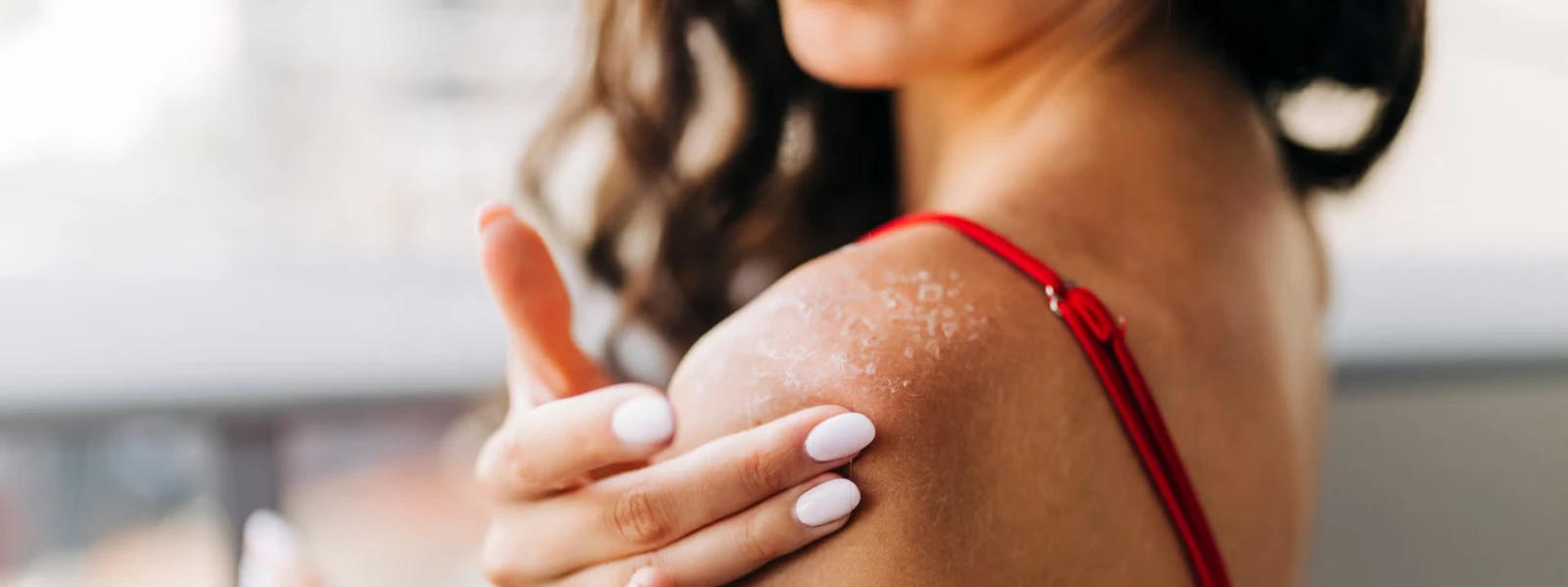 9 Benefits of Niacinamide for Body Acne in Dry Skin