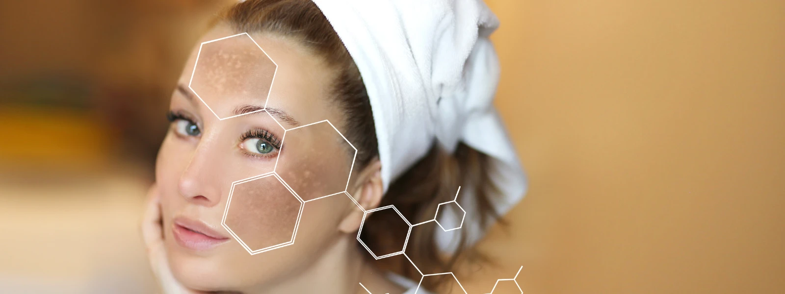 Hyperpigmentation on Chin: A Step-by-Step Treatment Guide