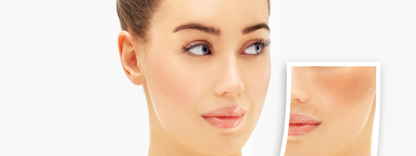 PCOS Hyperpigmentation FAQ: Understanding Skin Discoloration