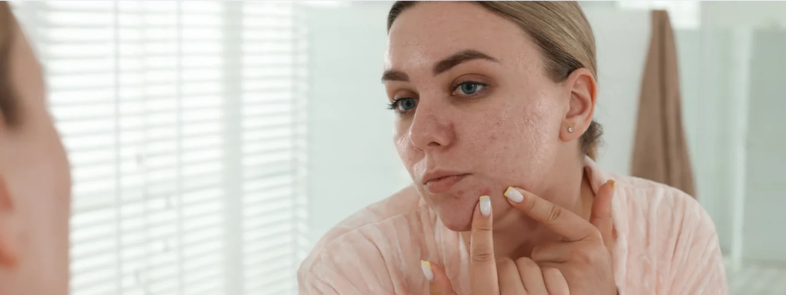 Why Teens Get Spots: Your Complete FAQ Guide