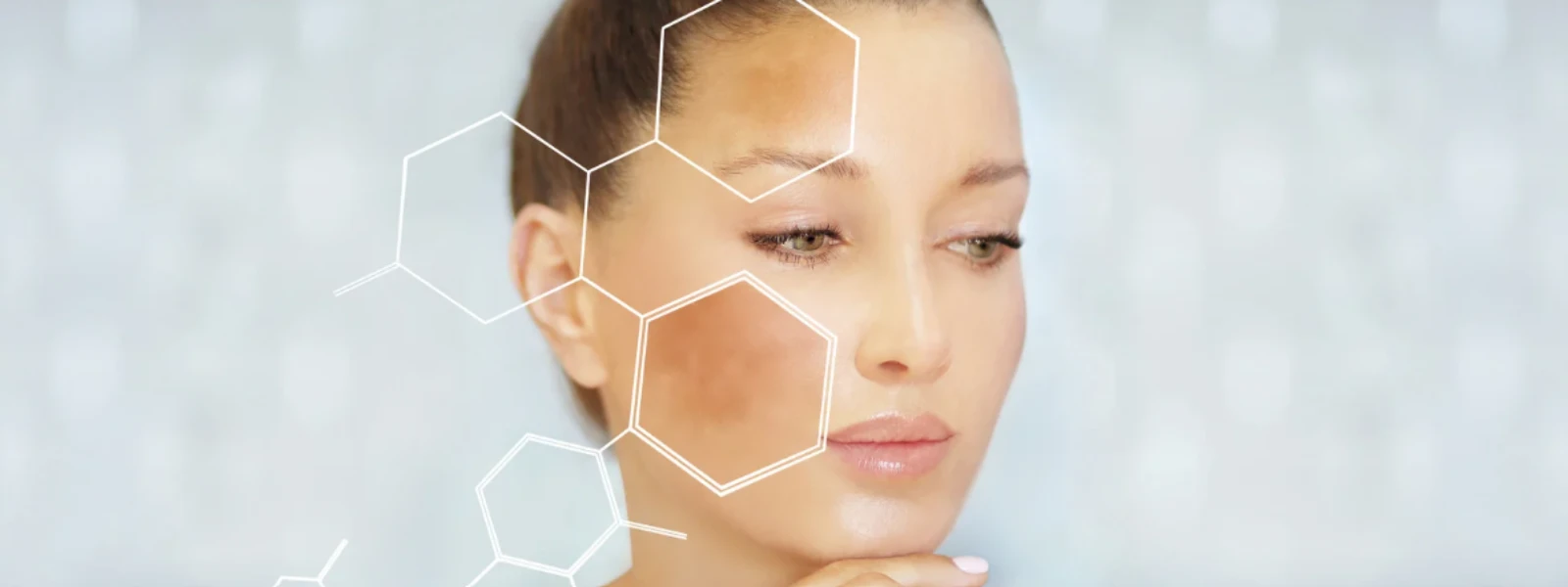 Brown Spots & Dark Patches: Your Questions on Causes, Answered