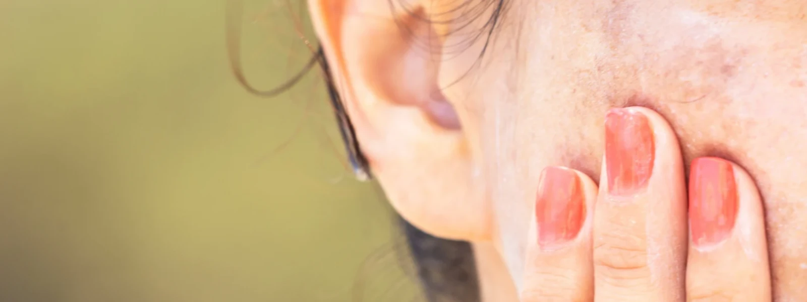 Ultimate Melasma Skin Care Routine Checklist