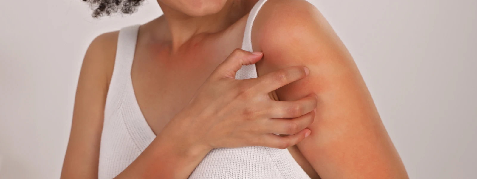 Reactive Skin vs. Allergy FAQ: Understanding the Difference