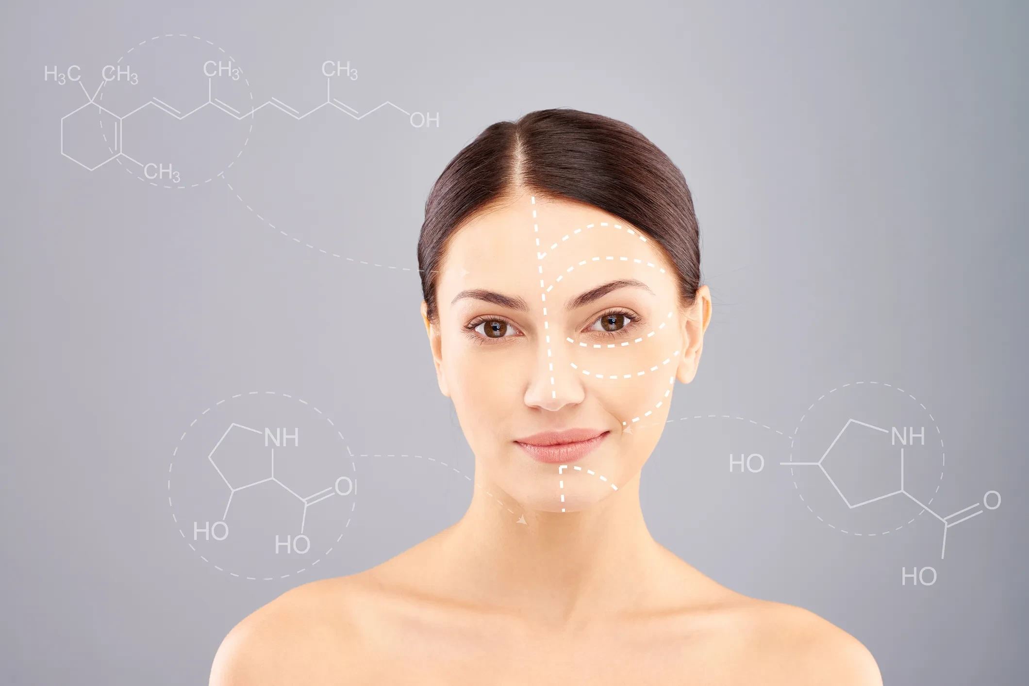Arbutin for Acne Scars: Your Complete Guide