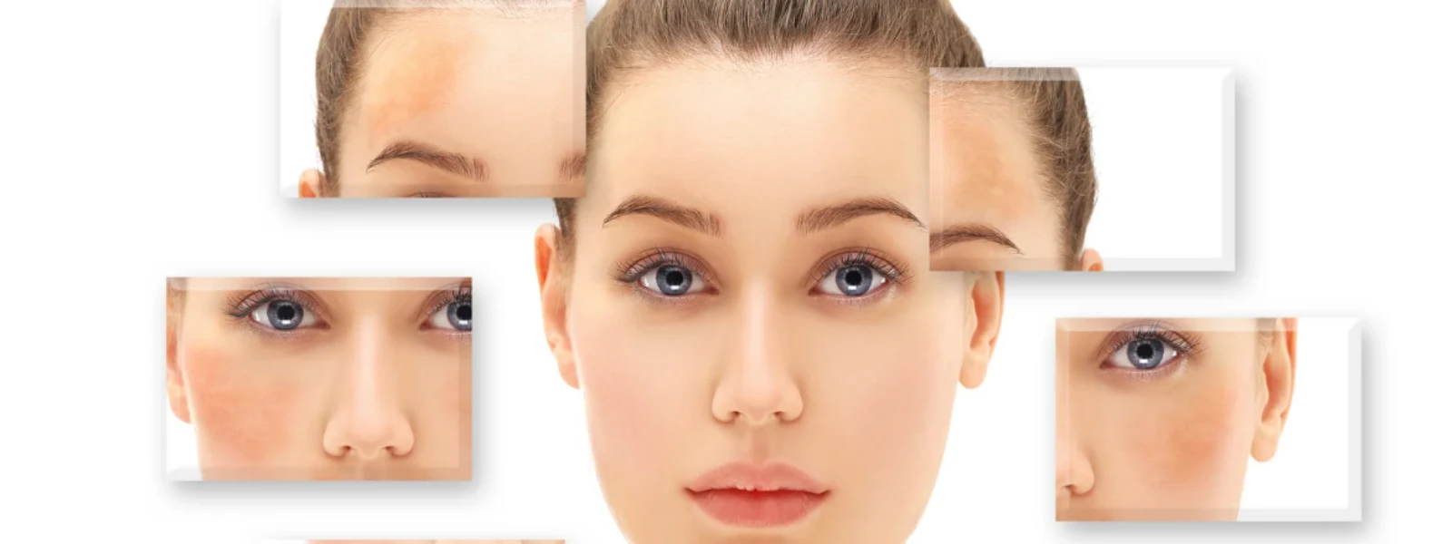 Choosing the Right Pigmentation Serum for Dark Spots, Acne Marks & Uneven Tone