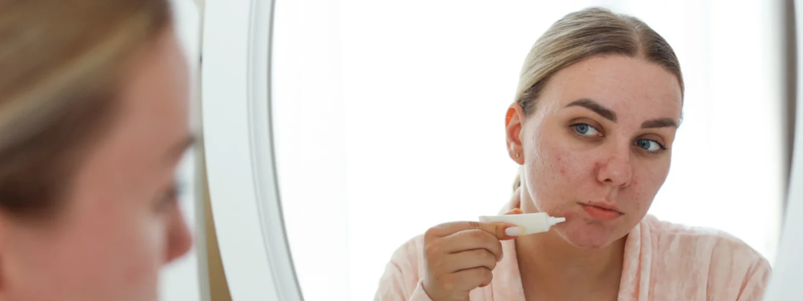 Clear Skin Means: Your Complete Acne Treatment Guide