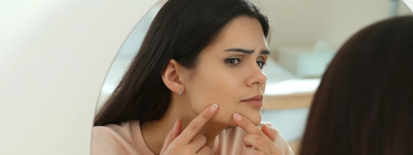 Essential Checklist: Identifying Hormonal Acne Causes