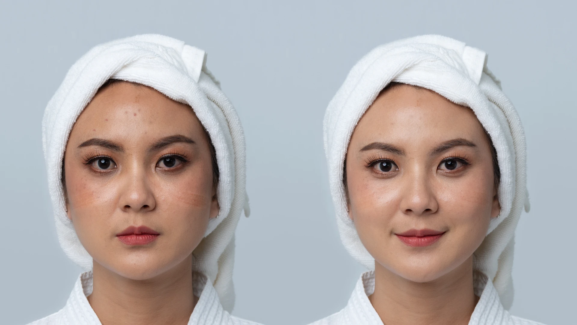 Essential Checklist: Identifying Hyperpigmentation Causes