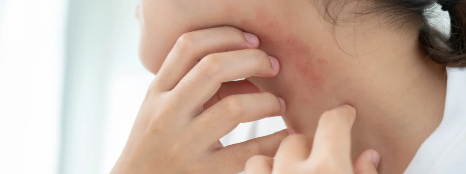 Essential Checklist: Preventing New Skin Scars Now