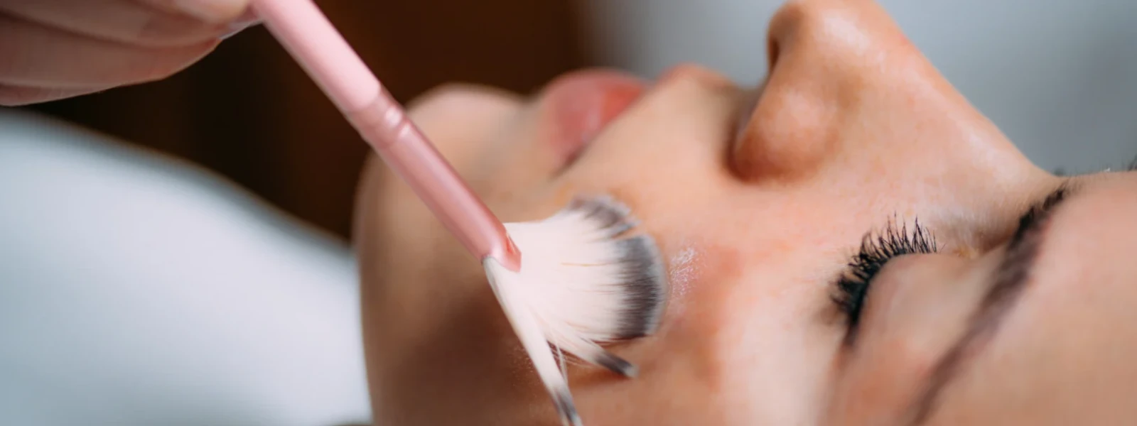 Essential Checklist: Tackle Hyperpigmentation Concerns