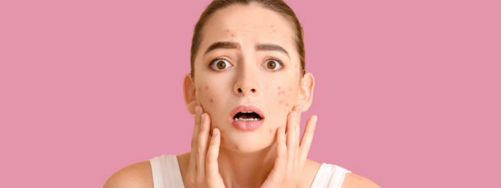Essential Checklist: Understanding Damp Spots & Hyperpigmentation Causes
