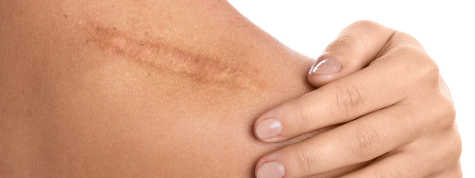 Heal Your Skin Barrier: Sun Damage Repair Guide
