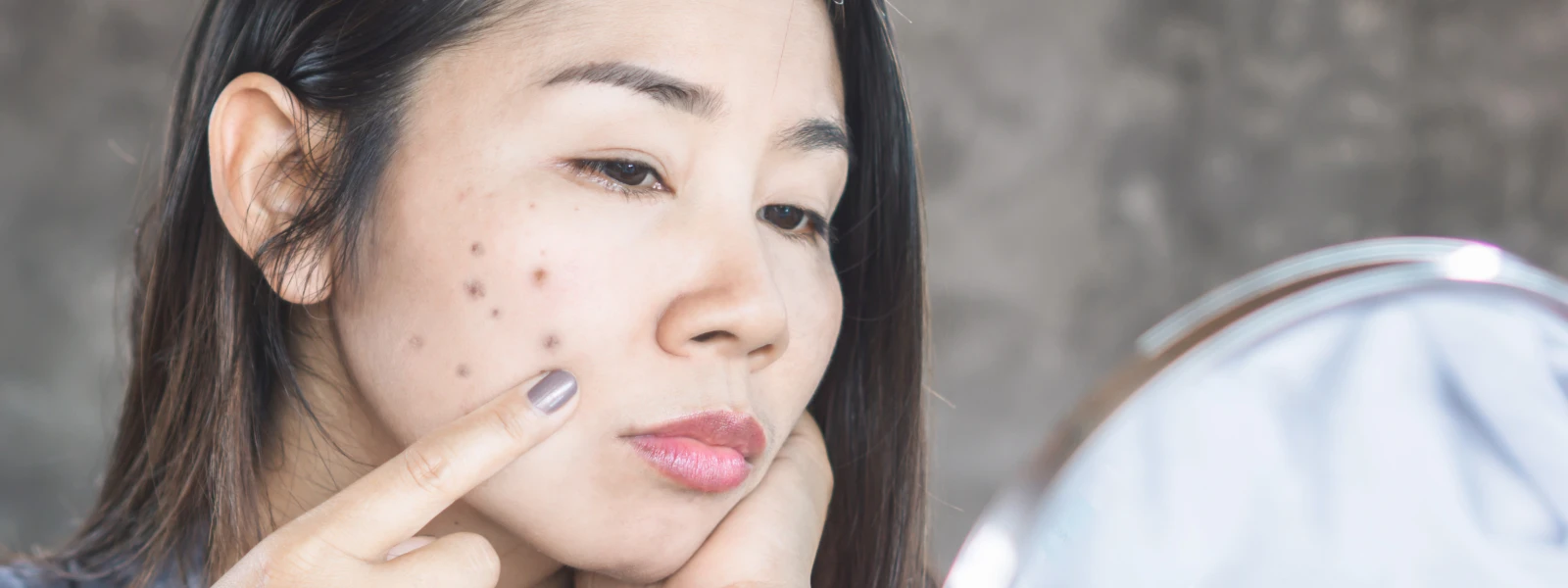 How to Find Sunscreen That Doesn't Clog Pores for Clear Skin