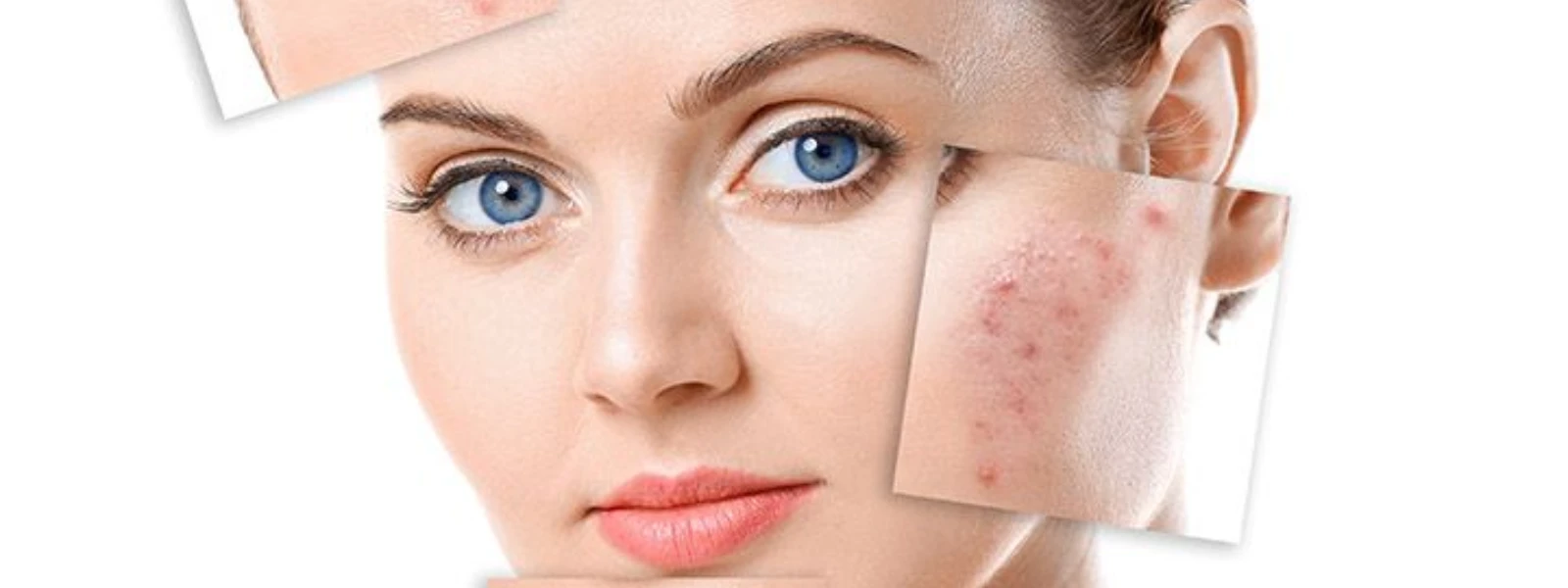 How to Get Smoother Skin Tone: Fade Dark Spots Effectively