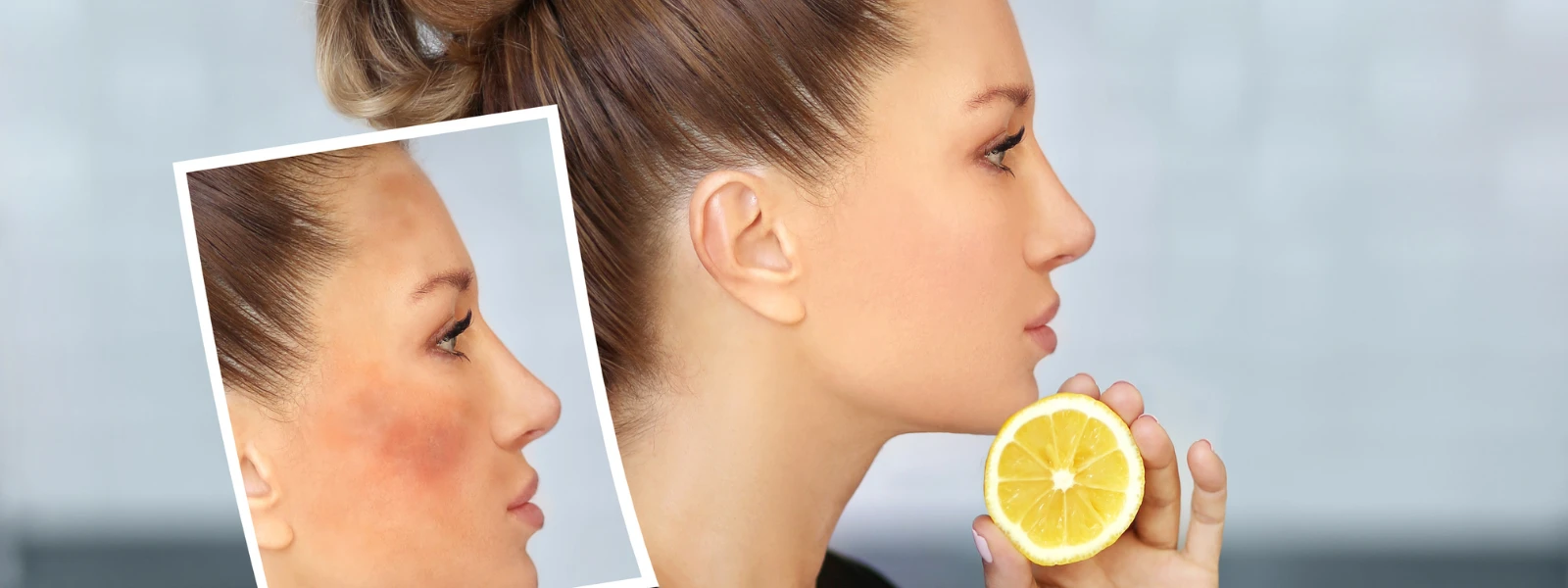 How to Identify the Causes of Indian Hyperpigmentation
