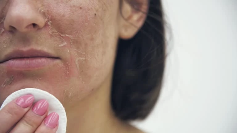 How to Tell Signs of Dry Skin: A Complete Tutorial