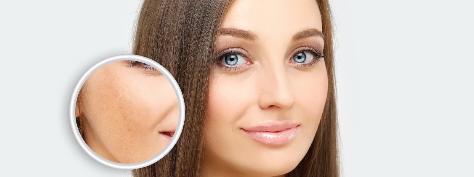 How to Treat Dark Spots on Indian Skin Effectively
