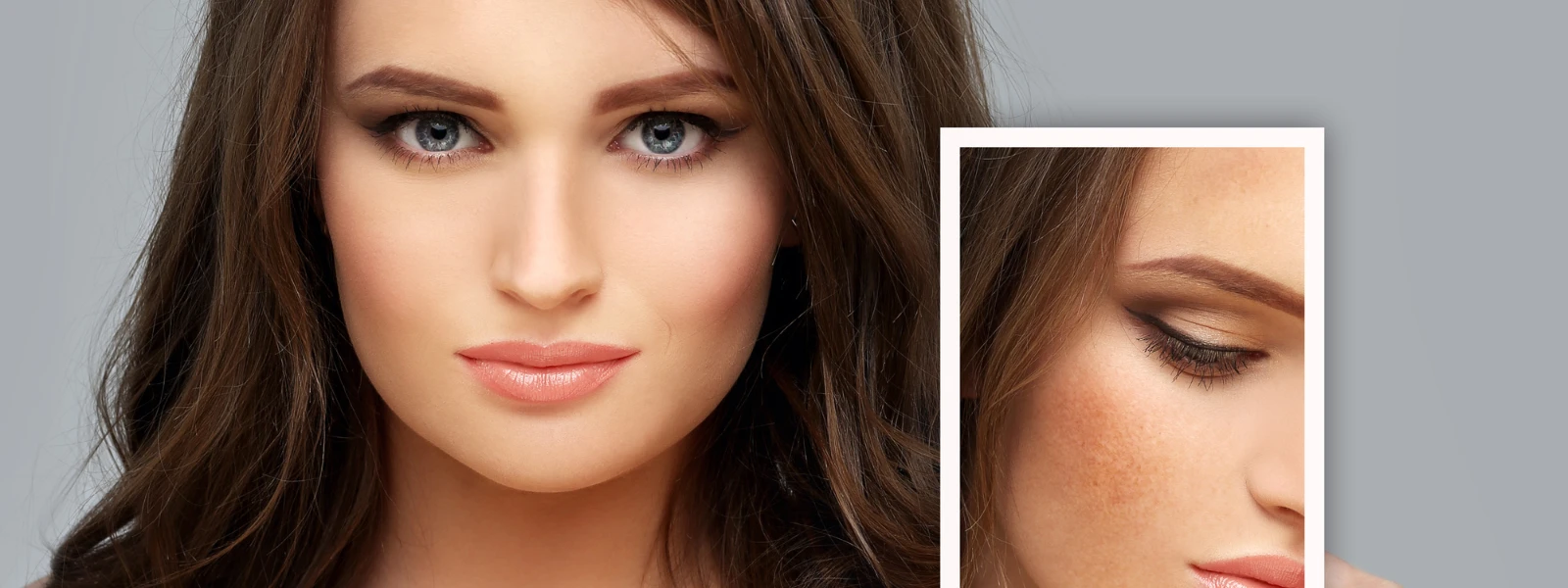 Hyperpigmentation During Pregnancy: A Step-by-Step Guide