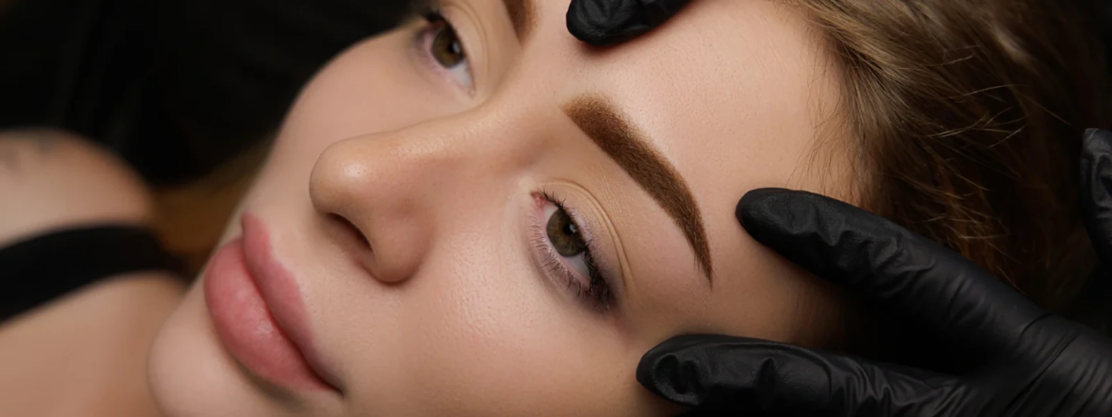 Melasma Laser Treatment: Your Complete FAQ Guide