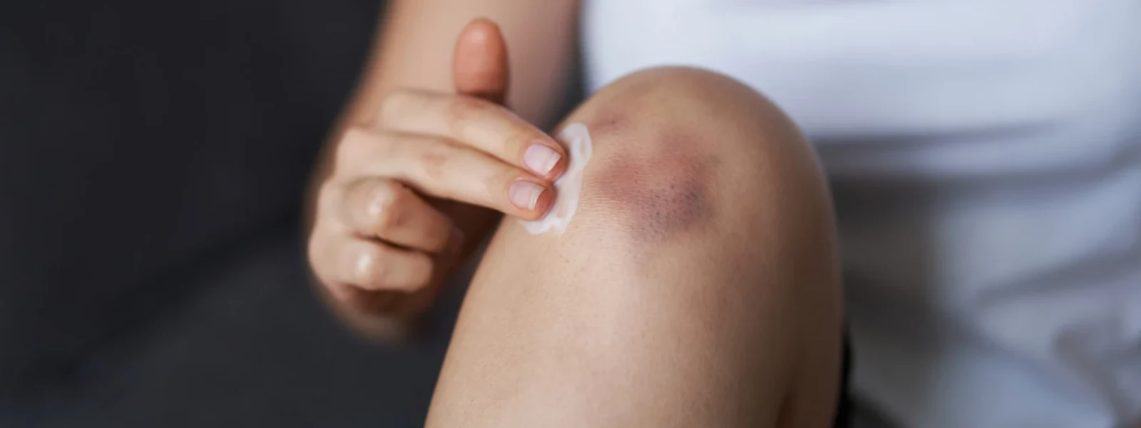 Niacinamide for Dark Knees: Your Complete Guide
