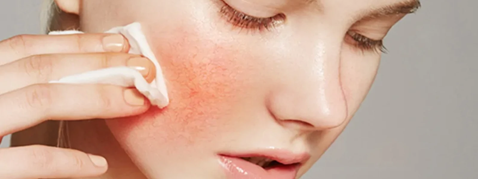 How to Identify Your Reactive Skin Triggers