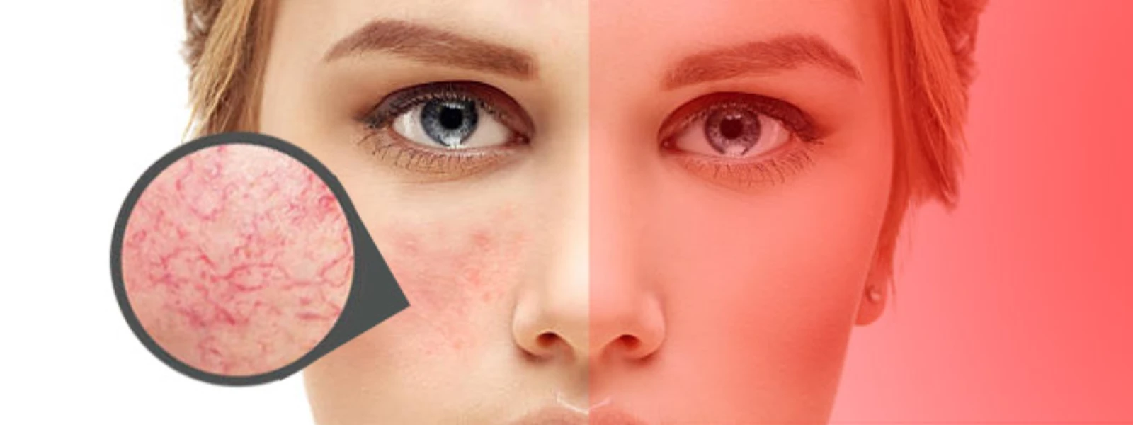 Sensitized Skin Causes & Treatments: Your FAQ