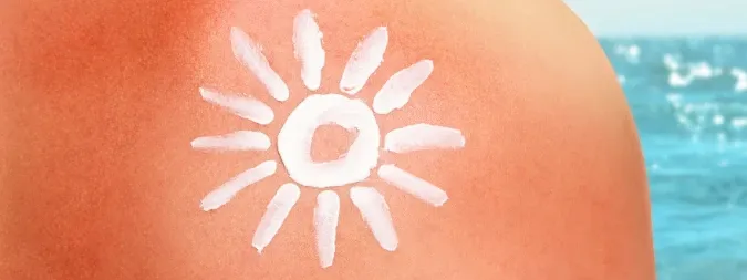 SPF Prevents Sunburn: Your Ultimate FAQ Guide