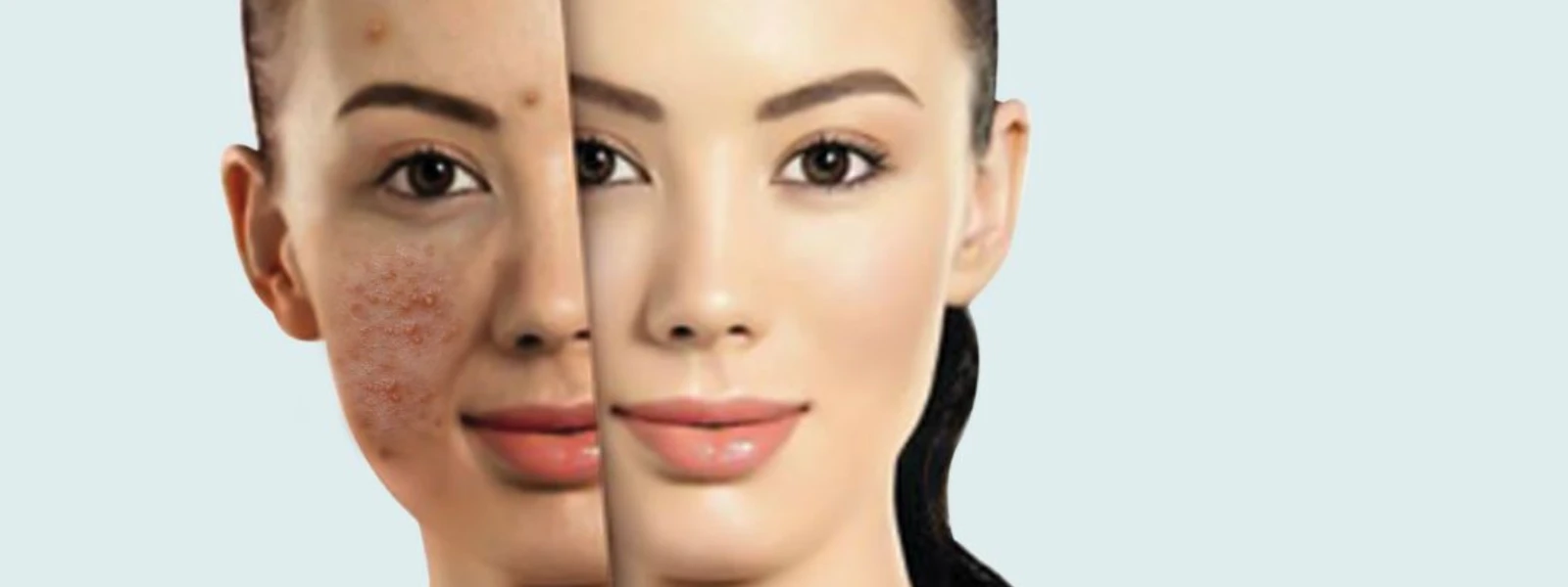 The Ultimate Checklist: Uncovering the Causes of Sudden Blemishes