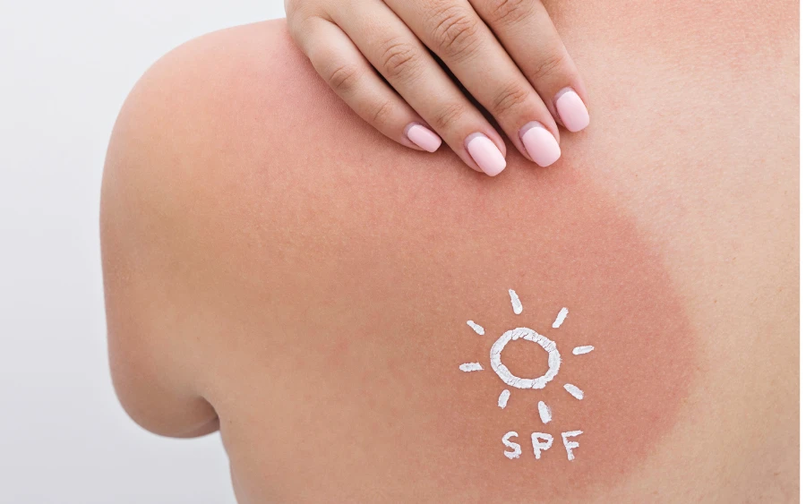 What are UV Rays and How Do They Affect Your Skin?