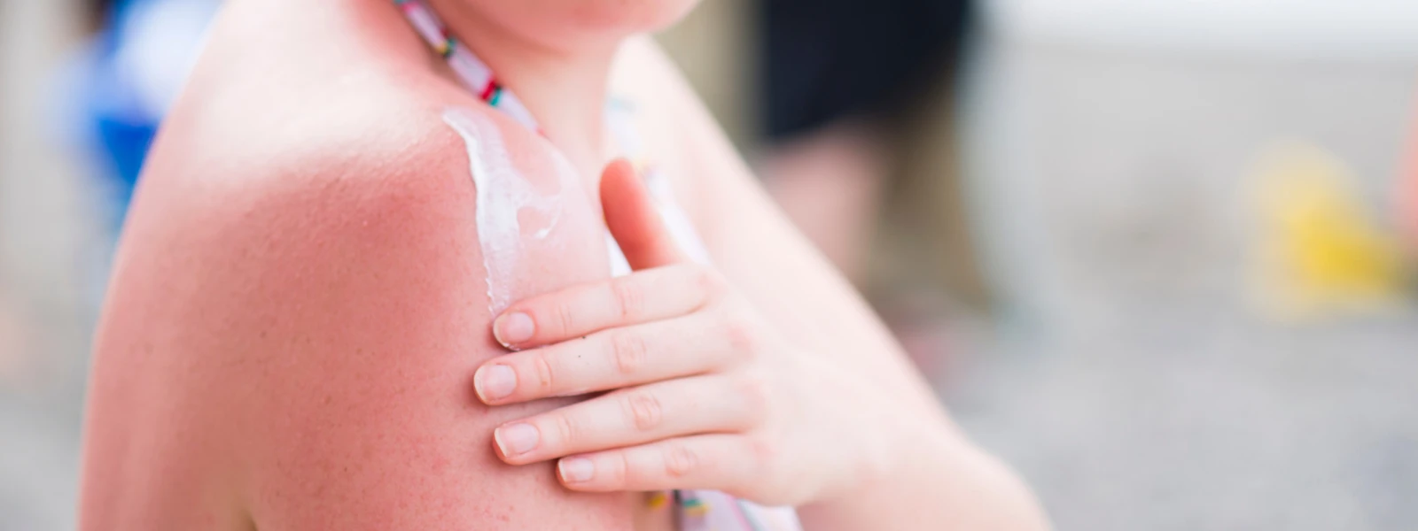 Winter Sun Protection Guide: Step-by-Step Tutorial