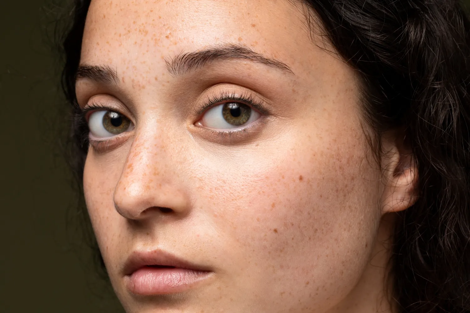Get Rid of Pigmentation & Dark Spots with the Best Serum