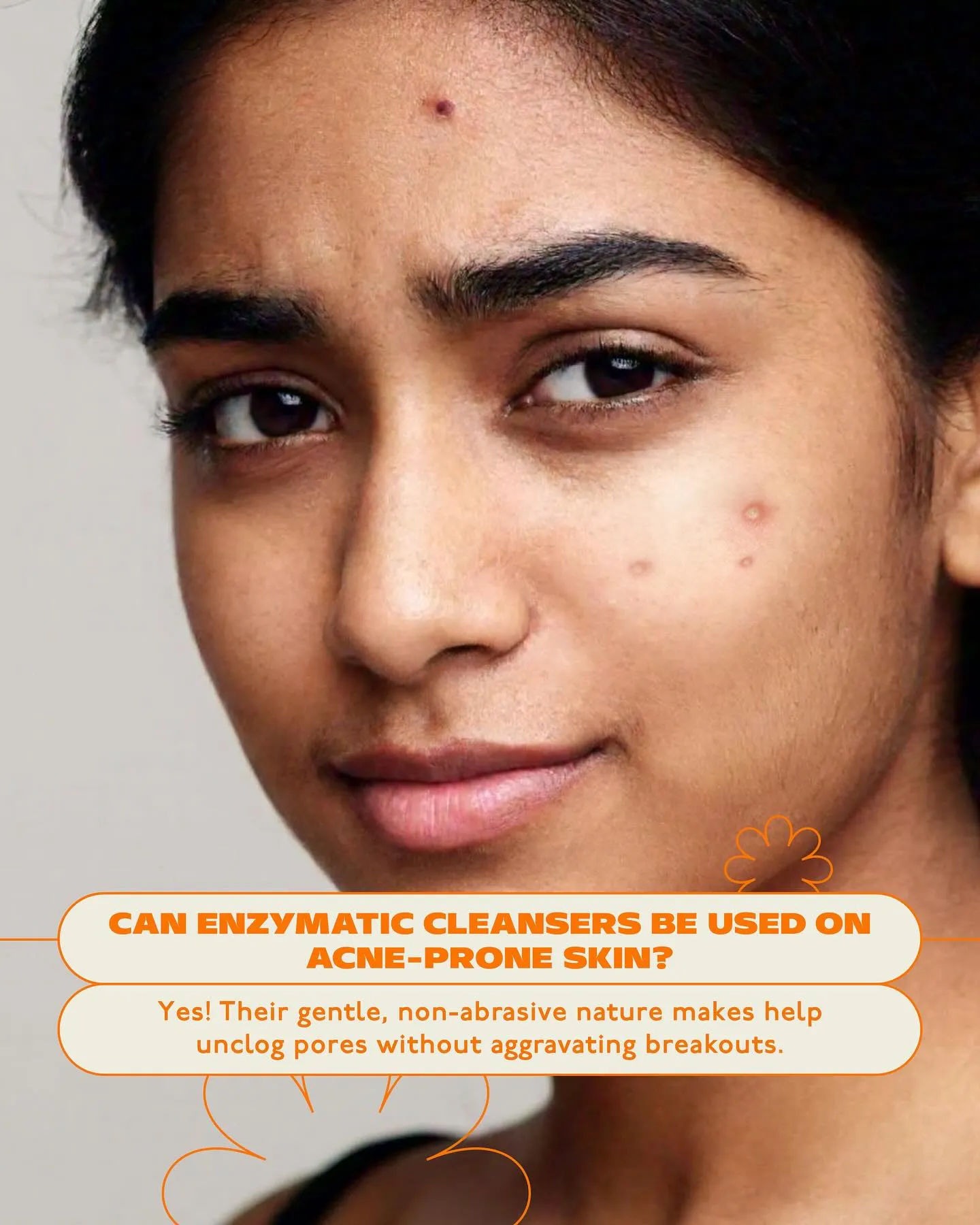 Best Sunscreen for Pimple Skin Care