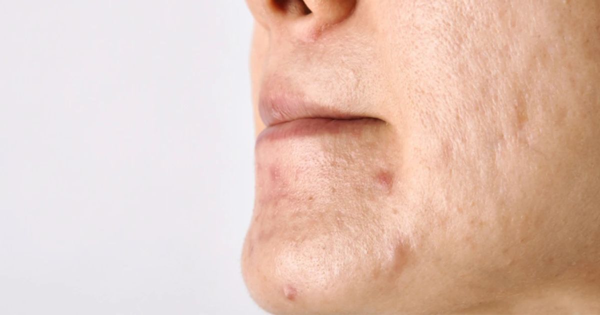 Essential Checklist: What Causes Rough Skin & Skin Texture Problems