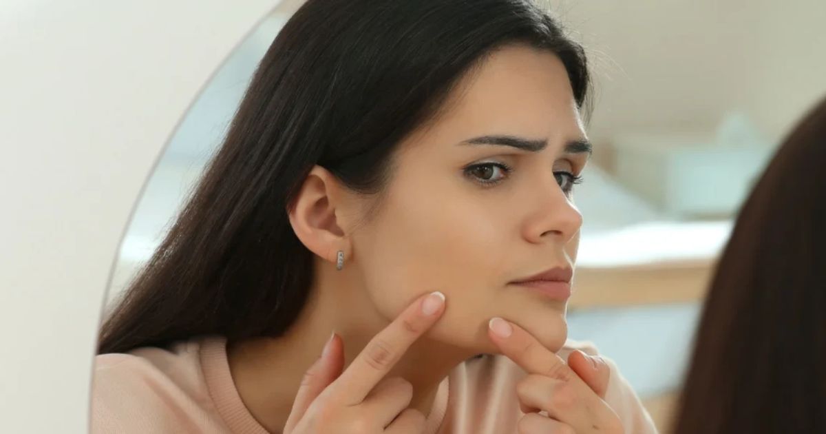 Causes of Skin Discoloration FAQ: Understanding Hyperpigmentation and ...