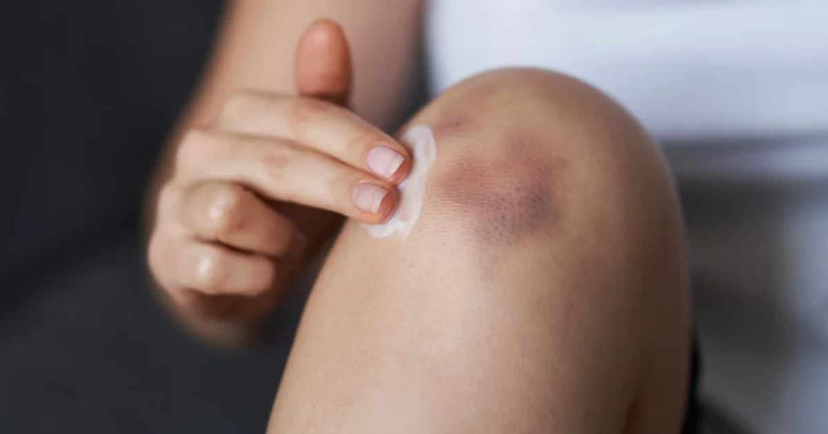 Elbow Pigmentation Home Remedies FAQ: Your Questions Answered