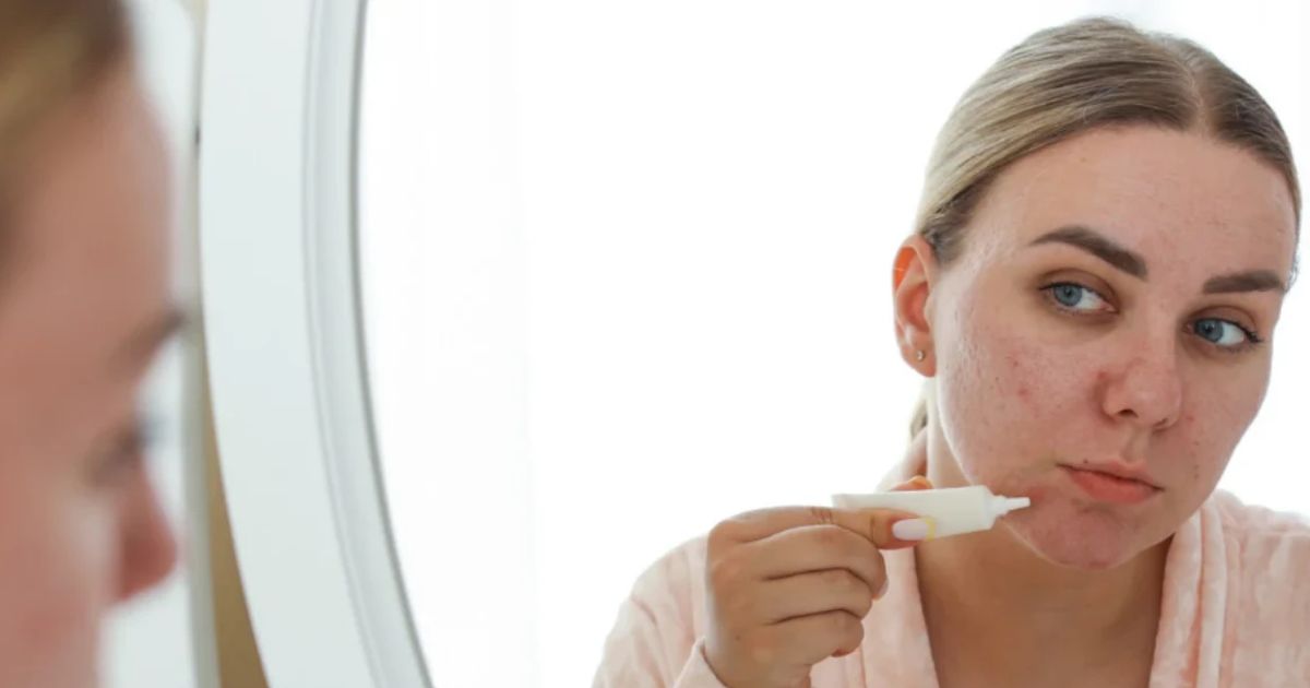 How to Reduce Dark Spots FAQ: Your Questions Answered