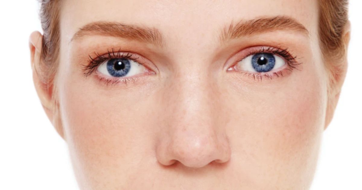 Lemon for Brown Spots FAQ: Does It Worsen Discoloration?