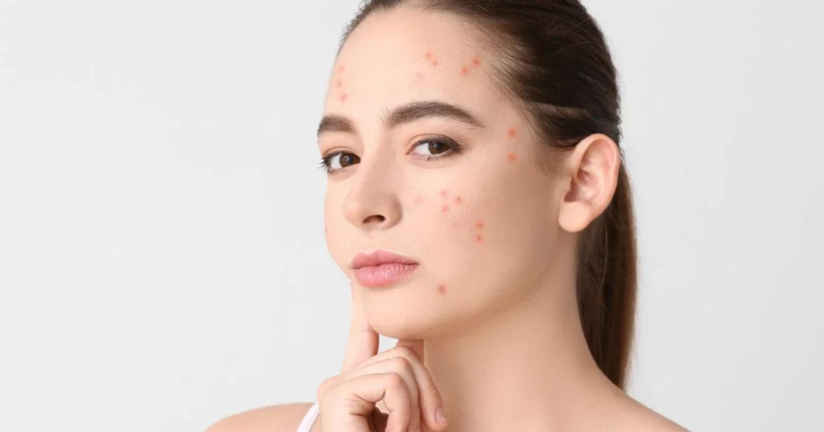 Reducing Dark Marks Urban FAQ: Your Questions Answered
