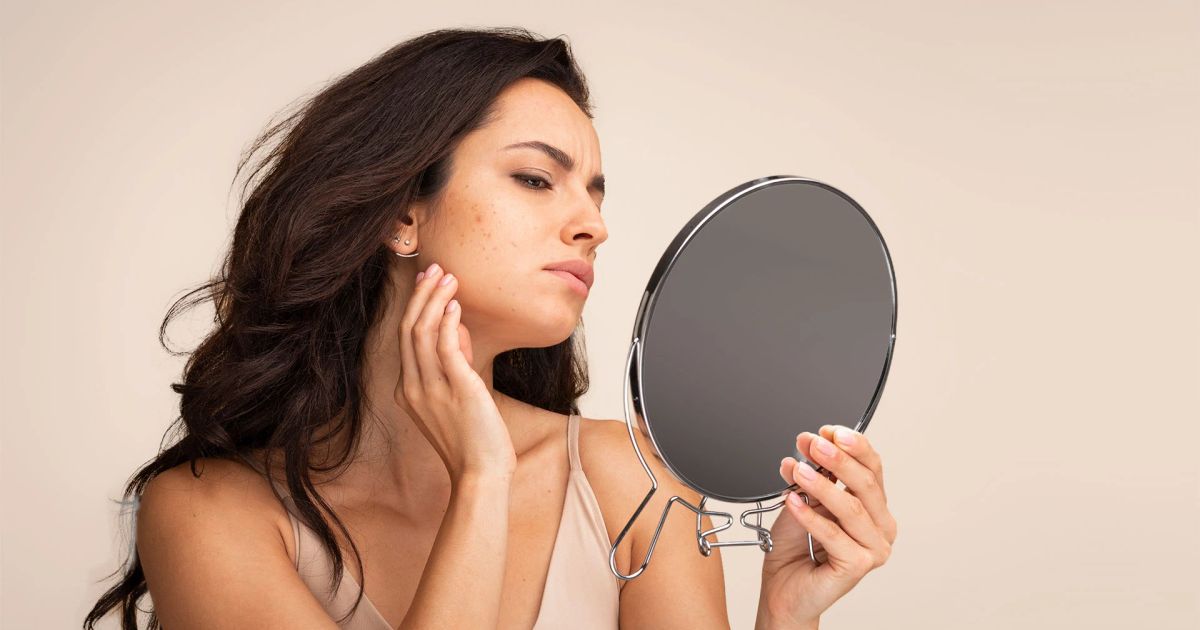 Rough Skin vs Hyperpigmentation FAQ: Understanding Skin Texture