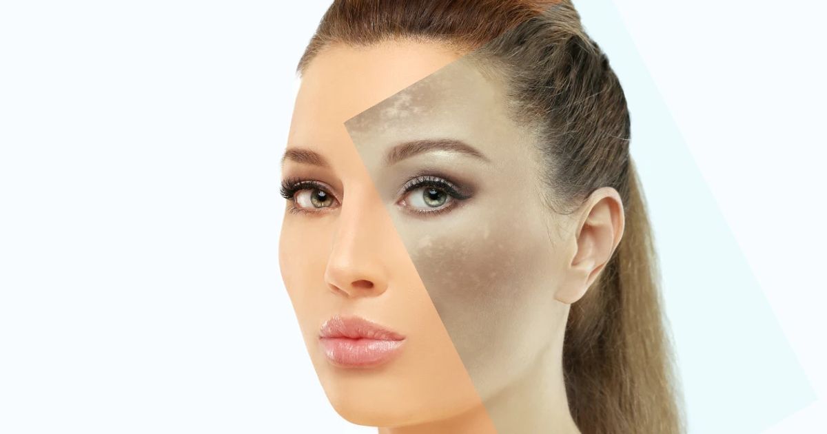 Signs of Sun Damage FAQ: Common Questions Answered